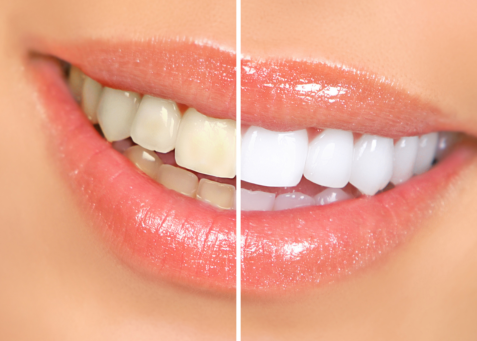 How to Naturally Keep Your Teeth White?